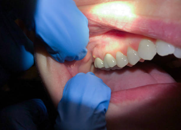 Best Weekend Emergency Dentist in Banner Hill, TN