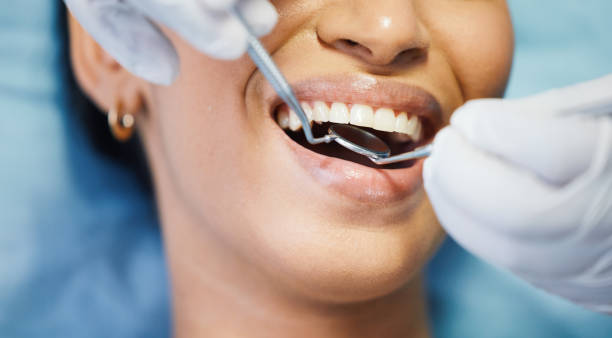 Best Emergency Dentist for Knocked-Out Tooth in Banner Hill, TN